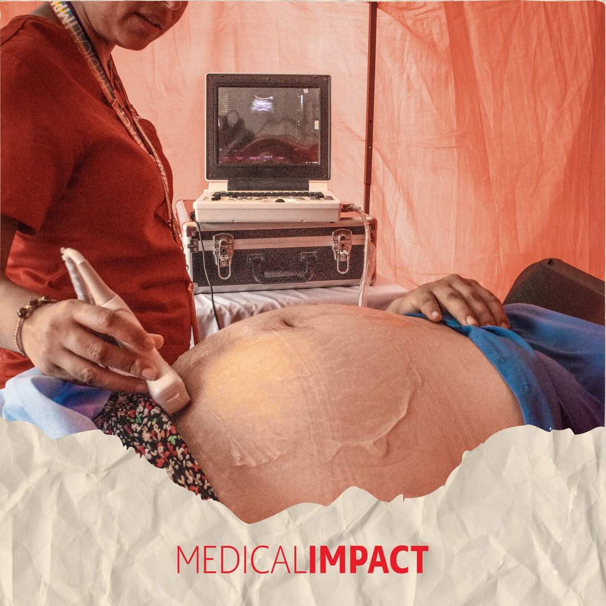 🔍 Da clic medical-impact.org/entendiendo-la… y descubre qué son las enfermedades congénitas, los métodos de detección y la importancia del seguimiento médico.

👣 La salud comienza desde el primer latido.

#EnfermedadesCongénitas #MedicinaPreventiva #SaludMaternoInfantil #MedicalImpact