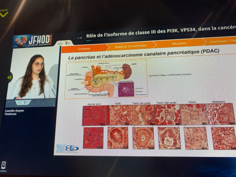 Guillermet's Lab (@guillermetlab) on Twitter photo Today, Camille Guyon presented her work on the partial inactivation of Vps34 in pancreatic cancer development and progression at the #JFHOD2025 #CECED2025!
A great work deciphering the implication of autophagy in the pancreas.
<a href="/crctoncopole/">CRCT-Oncopole</a> <a href="/Inserm/">Inserm</a> <a href="/CNRS_Toulouse/">CNRS Occitanie Ouest</a> Today, Camille Guyon presented her work on the partial inactivation of Vps34 in pancreatic cancer development and progression at the #JFHOD2025 #CECED2025!
A great work deciphering the implication of autophagy in the pancreas.
<a href="/crctoncopole/">CRCT-Oncopole</a> <a href="/Inserm/">Inserm</a> <a href="/CNRS_Toulouse/">CNRS Occitanie Ouest</a>