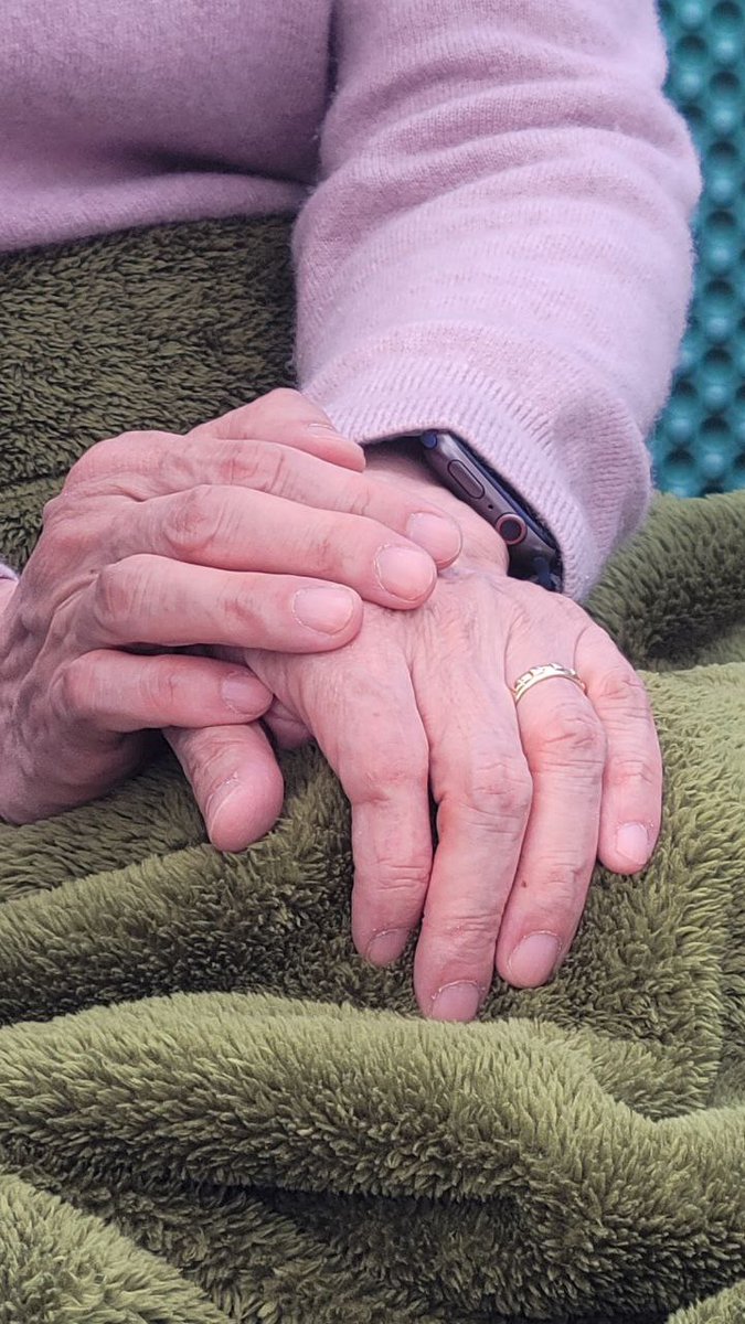 단식 13일차, 김경수 지사님 손..
얼굴은 웃고 있지만, 사력을 다해 싸우고 계십니다..

#김경수 #단식 #13일차 #윤석열 #내란수괴 #탄핵