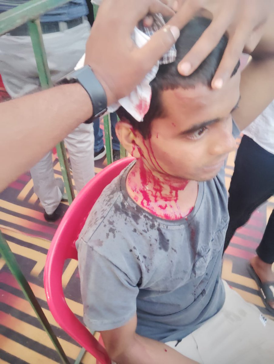 0f2Dreamer's tweet photo. 🚨 Bihar Students Attacked! 🚨

Bihar students were beaten at Guru Kashi University. Many injured, no action! @NitishKumar @BiharCMO must act now!

#HelpBiharStudents #WeWantJustice https://t.co/DO6kflKp3T