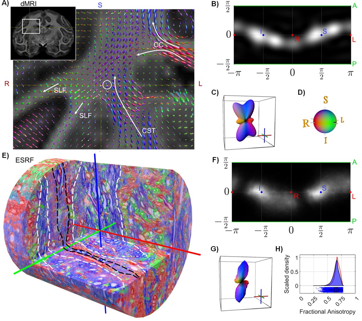 Frank Yeh (@fangchengyeh) on Twitter photo One of the most important recent works in dMRI field by <a href="/Tim_Dyrby/">Tim B. Dyrby</a> showing dMRI compared with microstructure.
A lot of insights into brain microstructure and macro structure. 👇🧠
A must read for those working on dMRI.
doi.org/10.7554/eLife.… One of the most important recent works in dMRI field by <a href="/Tim_Dyrby/">Tim B. Dyrby</a> showing dMRI compared with microstructure.
A lot of insights into brain microstructure and macro structure. 👇🧠
A must read for those working on dMRI.
doi.org/10.7554/eLife.…