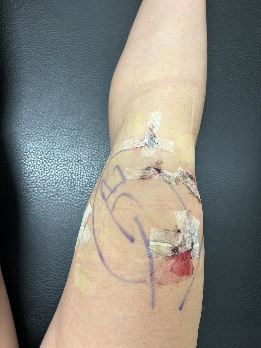 rileylovern12's tweet photo. A year ago from today was the day that changed my life and soccer career in so many ways. I have learned how to walk &amp; run again, face fears &amp; trust myself, step back onto the soccer feild, and do everyday activities again! Thank you mom for being my biggest encouragement. 💓 https://t.co/6nUY4AxYXZ