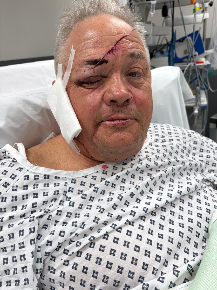 Everyone at NUST sends their well wishes to #NUFC supporter, Robert Turner, who was violently attacked in his own home on Saturday. Robert missed attending the cup final at Wembley as a result 💔 

Thank you to former <a href="/ManCity/">Manchester City</a> physio, Roy Bailey <a href="/wizzo3333/">Roy Bailey wizzo</a>, for making us aware.