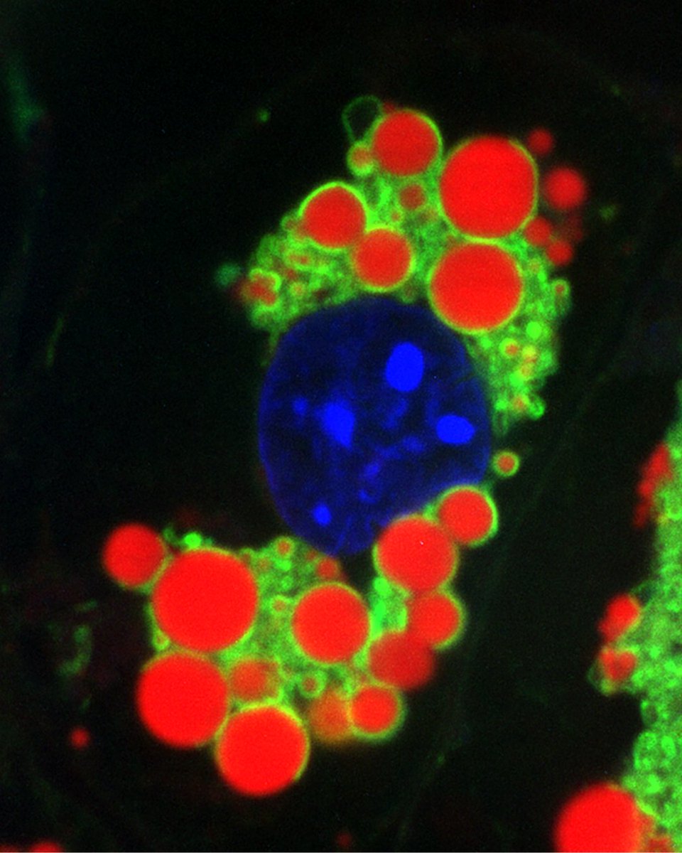 officialbiohub's tweet image. Witness the dynamic interaction of mitochondria (🟢) + lipid droplets (🔴) during fat cell differentiation. The nature of these contacts determines the metabolic signature of the cell