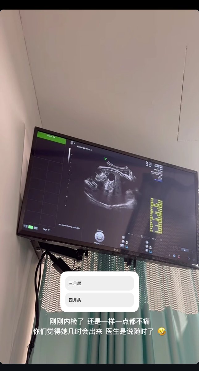 没见过这么骚的女人，快生了还这么骚，第一次看人被医生抠逼了还能这么开心炫耀的😂估计今天被医生弄舒服了