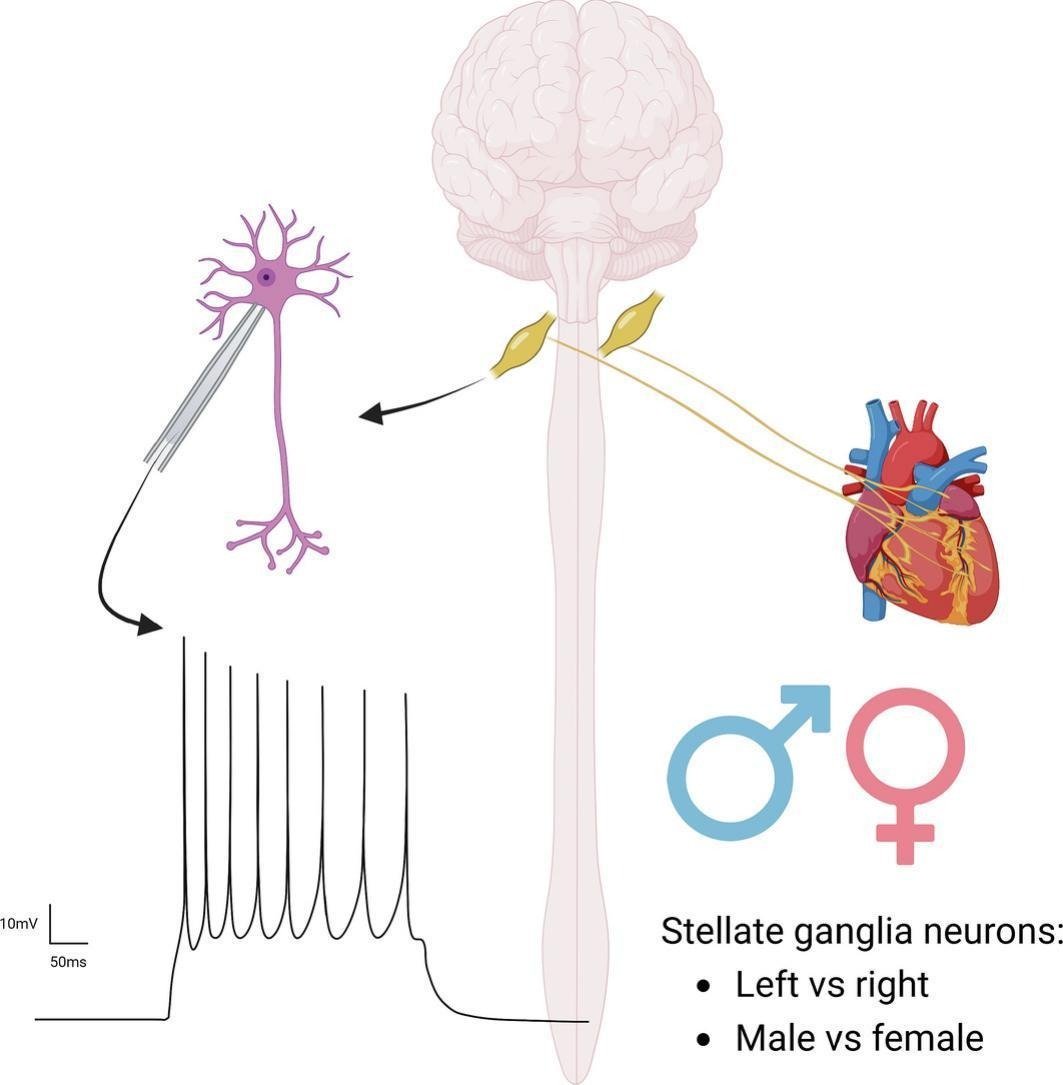 JMCC Plus (@jmccplus) on Twitter photo New Paper Alert!
New work just out from <a href="/MollyOReillyy/">Molly O'Reilly</a> ,<a href="/CarolRemme/">Carol Ann Remme</a> and Arie Verkerk <a href="/amsterdamumc/">Amsterdam UMC</a> investigated differences in the #electrophysiology of the left and right stellate ganglia
What repercussions may this have for #Arrhythmia generation?
sciencedirect.com/science/articl… New Paper Alert!
New work just out from <a href="/MollyOReillyy/">Molly O'Reilly</a> ,<a href="/CarolRemme/">Carol Ann Remme</a> and Arie Verkerk <a href="/amsterdamumc/">Amsterdam UMC</a> investigated differences in the #electrophysiology of the left and right stellate ganglia
What repercussions may this have for #Arrhythmia generation?
sciencedirect.com/science/articl…