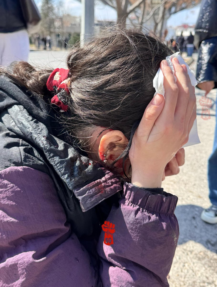 Dokuz Eylül Üniversitesi'nde bir öğrenci, polis müdahalesi sırasında kafasına plastik mermi isabet etmesi sonucu yaralandı…