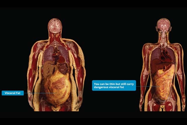 9 Ways to Live Longer &amp; Avoid an Early Death 👇

Most people focus on looking good - but what about staying alive?

These 9 habits will extend your life and improve your quality of living: