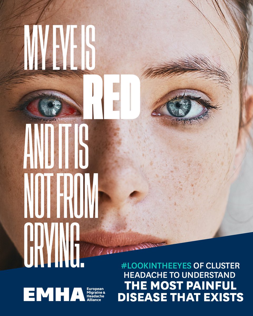 Having a red eye is one of the many symptoms of cluster headache. The more we understand about this terrible disease, the more awareness we can raise towards it #ClusterHeadache