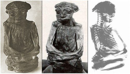 WorldMovieAward's tweet photo. The Mystery of the San Pedro Mountains Mummy

In 1932, two prospectors searching for gold in the San Pedro Mountains of Wyoming stumbled upon a small cave sealed by rock. Inside, they found a tiny, mummified human figure sitting upright. Measuring only 14 inches tall, the mummy had a flattened skull, deeply wrinkled skin, and a fully developed adult-like appearance, sparking theories of an ancient, unknown civilization.

Local Native American legends, particularly from the Shoshone and Crow tribes, spoke of the Nimerigar, a race of small, aggressive people who lived in the mountains and were said to attack intruders with poison arrows. The discovery of the mummy raised questions about whether these cultural stories were based on real events. Was the mummy evidence of this lost race, or was it a medical anomaly? The connection between folklore and the find deepens the mystery.

Shortly after being examined, the mummy disappeared, and its whereabouts remain unknown to this day. Whether it was a genetic anomaly, an ancient burial, or proof of a mythical people, the San Pedro Mountains Mummy remains one of North America’s strangest archaeological enigmas, blending indigenous culture, mythology, and unexplained history.

Photo credit: Archaeological Art