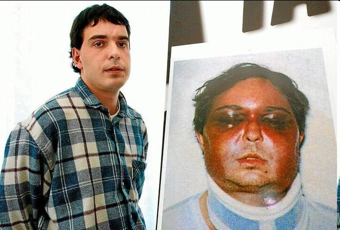 outsidersesp's tweet photo. El 6 de septiembre del 2001 la Guardia Civil detenía a Unai Romano, acusado de colaboración con banda armada.

Así le dejaron la cara después de varios días incomunicado.

El juez, Grande Marlaska, no vio indicios de torturas.

Unai Romano acabaría siendo absuelto. https://t.co/DXJVLvegy7