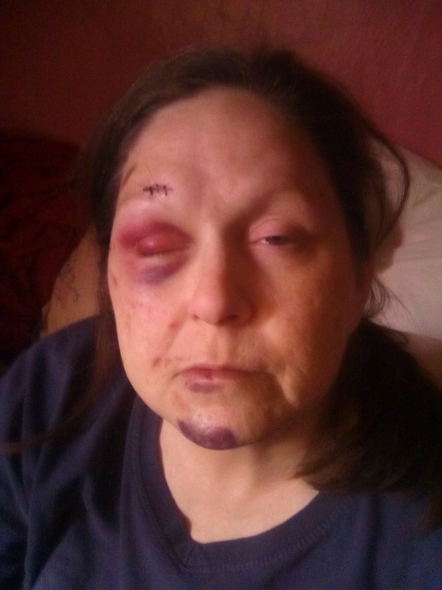 Was in an accident. Nothing coming in right now, in dire need of a little financial assistance. Please help. $leshom76