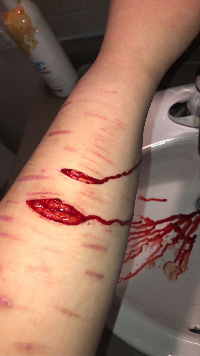 zenryxx's tweet photo. Stupid twitter But repost😔 { #Shtwt } https://t.co/7jNYFpT4FM