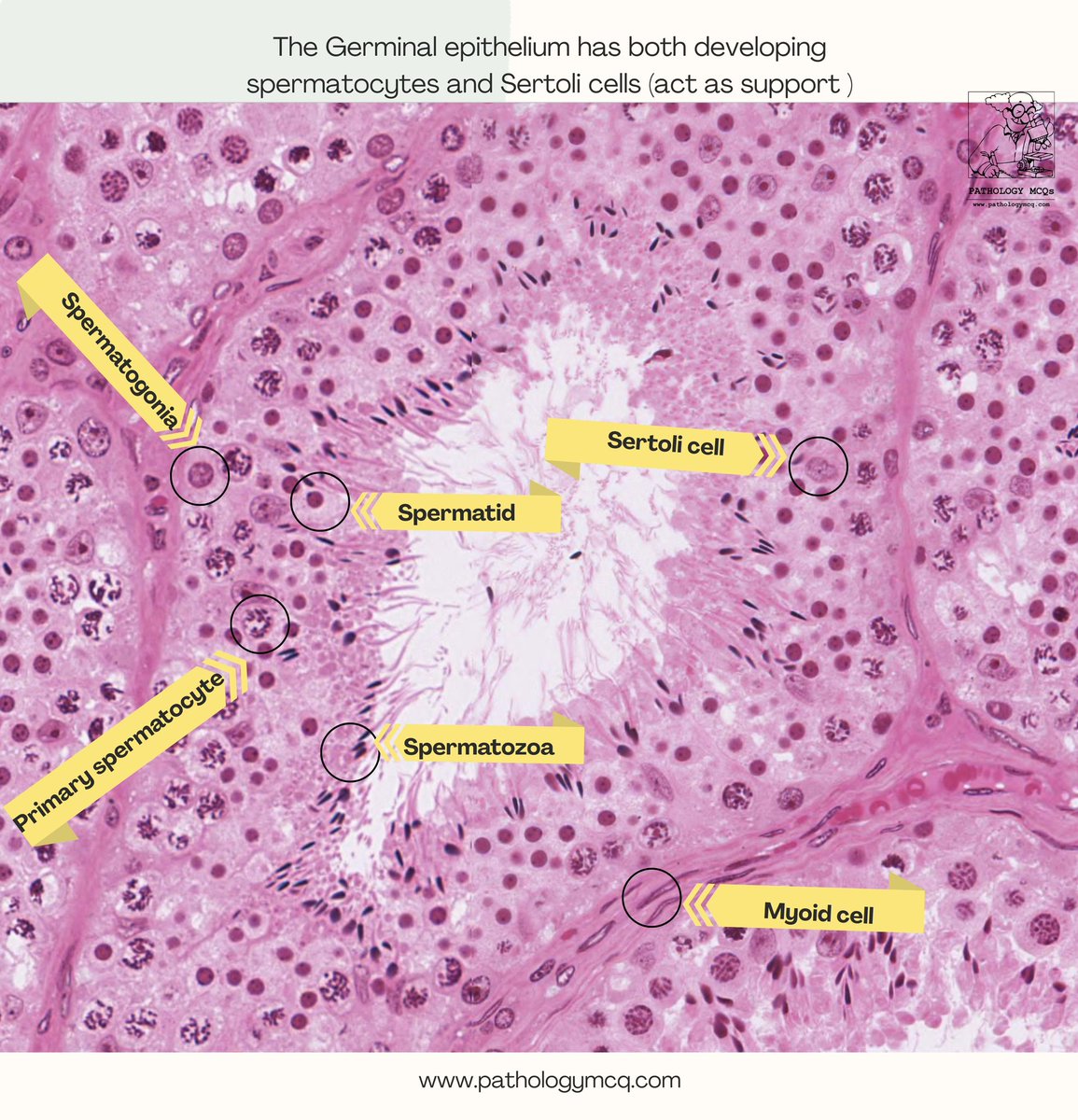 🔬 Testicular Biopsy : Histopathology Essentials 🔬

Ever wondered how to identify cells in a testicular biopsy? 🧐 Here’s a crash course on the histopathology of spermatogenesis and supporting cells!