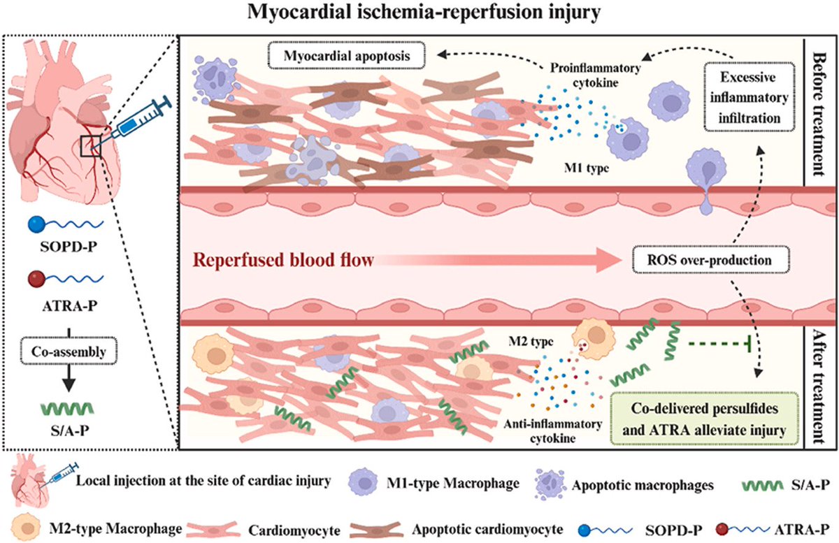 Biomaterials_'s tweet image. Superoxide anion-responsive persulfide and all-trans retinoic acid co-donating peptide assemblies attenuate myocardial ischemia-reperfusion injury sciencedirect.com/science/articl…