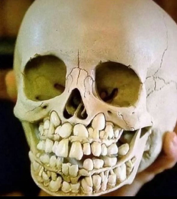 A child’s skull  before they lose their baby teeth with their adult teeth developing in their gums. 

Thank you for  coming to my TedTalk.