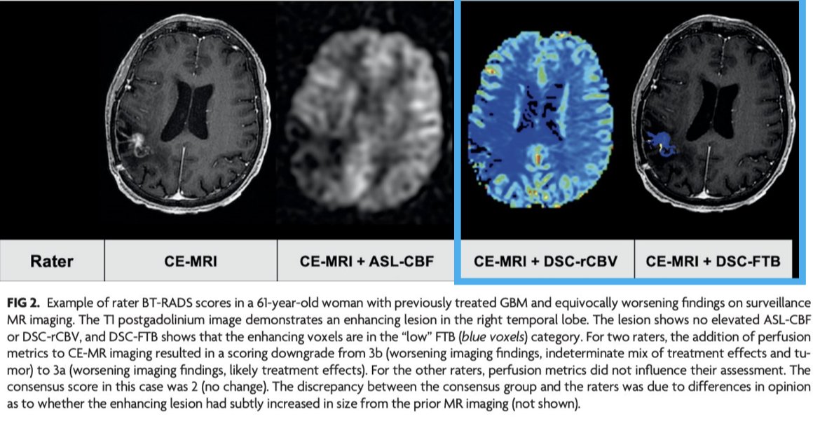 Don't miss this Multisite Benchmark Study
mailchi.mp/imagingbiometr…