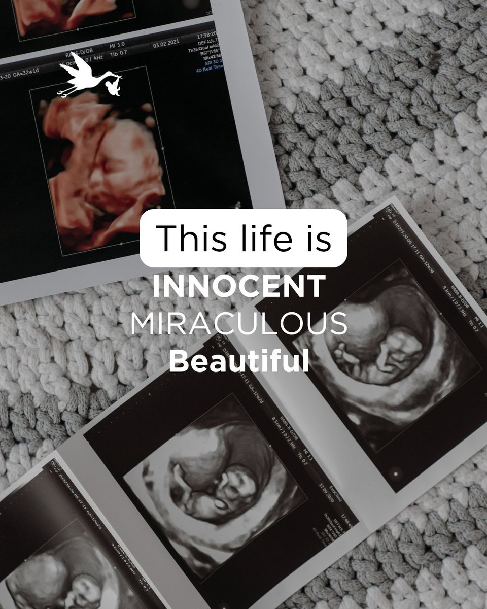 savethestorks's tweet photo. Every life is a miracle, starting from the moment of conception. Innocent, beautiful, and full of wonder.
#everylifematters #chooselife #savethestorks https://t.co/2u5JPpPEZc