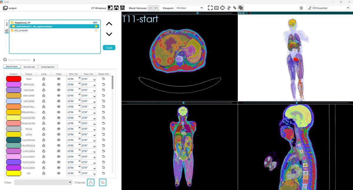We're proud to have presented at the National PET Imaging Platform (NPIP) earlier today – <a href="/NPIP_Org/">NPIP</a>  is the UK's first-of-its-kind national total-body PET imaging platform for driving forward world-leading drug discovery research.

<a href="/VoronoiHealth/">Voronoi Health Analytics Inc.</a>'s DAFS Platform is uniquely
