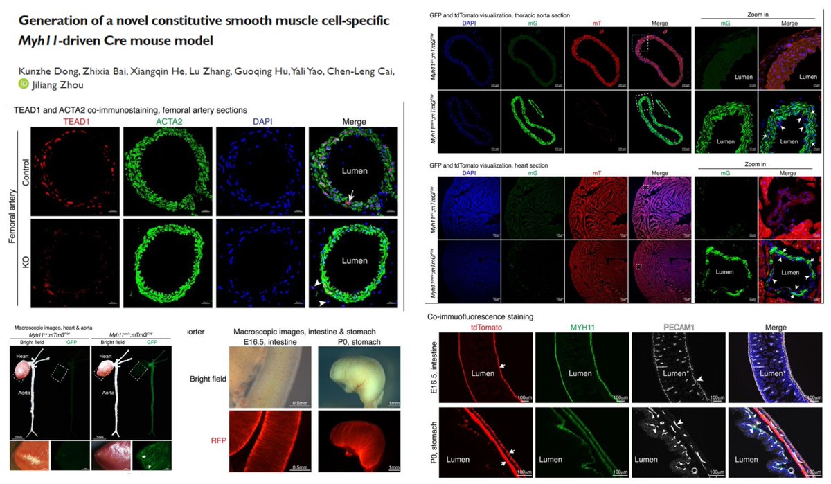 A constitutive #SmoothMuscleCell-specific Cre mice under precise control of endogenous Myh11 loci🤠

This time, we do not need to worry about off-targeting embryonic cardiomyocyte or male gamete😁

<a href="/KDong05305747/">Kunzhe Dong</a> <a href="/zhou_fun/">Zhou Smooth Muscle Lab</a> bioRxiv 2024
biorxiv.org/content/10.110…