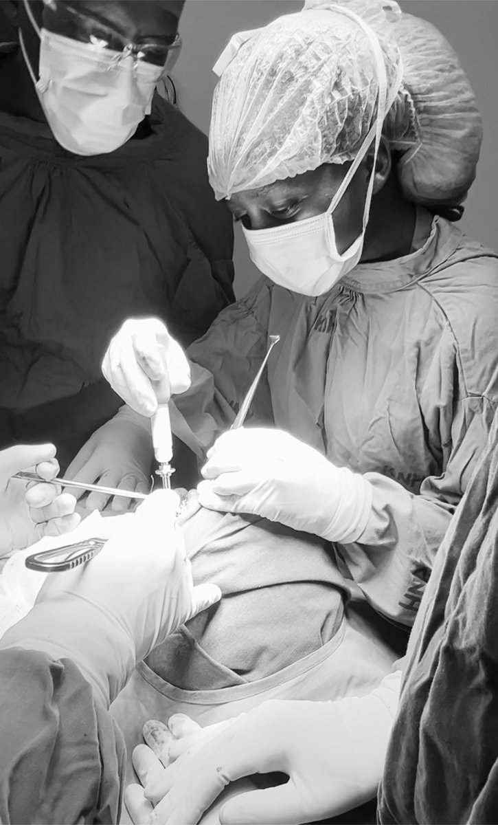 I did some bad ass things this week 
Many thanks to my consultants who believed in my capabilities 
Did OriF for bilateral mandibular fracture 
Figure of 8 wiring for an angle fracture 
Circummandibular  wiring for a body fracture for a 9 year old 
Orif for a sympyseal fracture