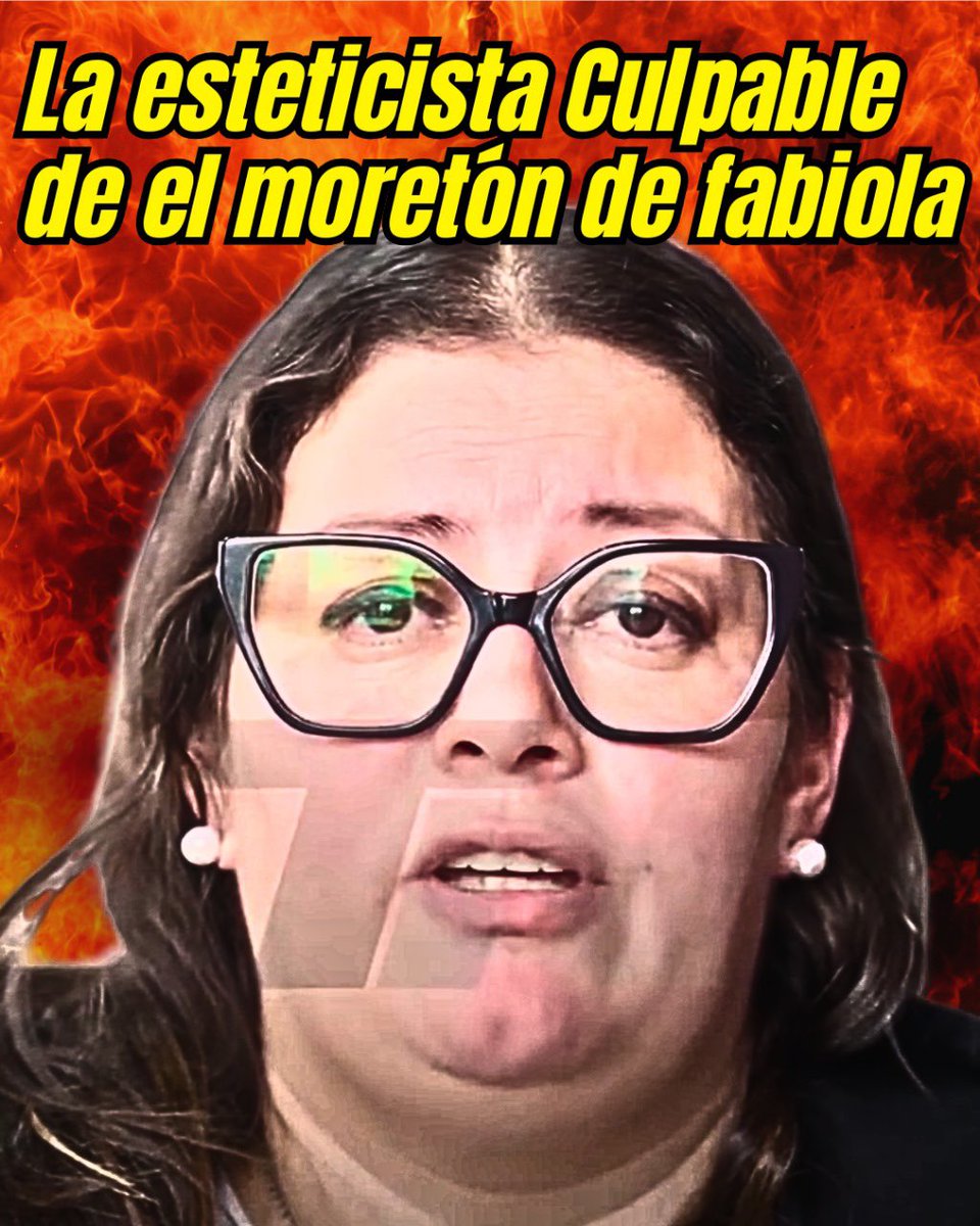 💉🚨La JUSTICIA CONFIRMÓ que la ESTETICISTA le aplicó PLASMA a FABIOLA en OLIVOS.

El MORETÓN fue producto de la INYECCIÓN.💉

MINTIÓ bajo juramento, va a juicio oral por EJERCICIO ILEGAL de la medicina y deberá afrontar el proceso por FALSO TESTIMONIO.