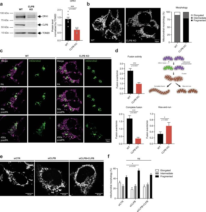 Excited to have contributed in a small way to this project:

Dependence of mitochondrial calcium signalling and dynamics on the disaggregase, CLPB