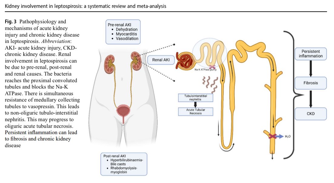 #Leptospirosis &amp; the #Kidney: A Deadly Duo🦠🫘

Lepto= non-oliguric #AKI→ ATN→ #CKD by blocking Na-K ATPase &amp; inducing vasopressin resistance! Persistent inflammation= fibrosis &amp; kidney failure.

🔗doi.org/10.1007/s15010… 🆕 2025

#Nephrology #InfectiousDiseases #MedTwitter #IM