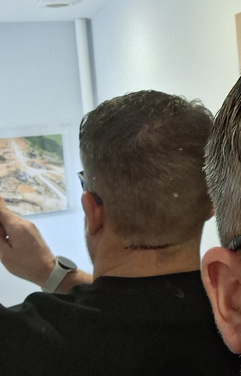 Back to being Frankenstein's Twin, the consultant didn't answer when I asked will it make me bowl faster