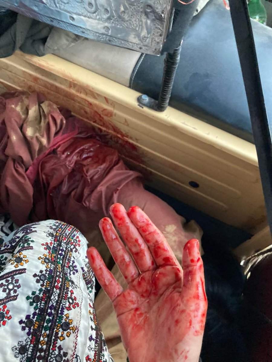 Basitbaloch201's tweet photo. تم اپنے گھر والوں کے ساتھ بہترین کھانوں کے ساتھ افطار کرو اور ہم اپنے نوجوان کے خون کے بو سے افطار کریں بس ہیی فرق ہے تمھارے اور میتمرے نظریات میں 
#BalochistanBleeds
#Balochistan  #BalochGenocide https://t.co/Qkd4alsxeP