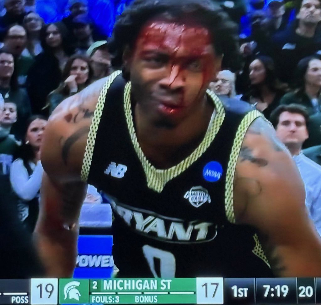 BarstoolBigCat's tweet photo. Just a scratch https://t.co/459FRFhsXj