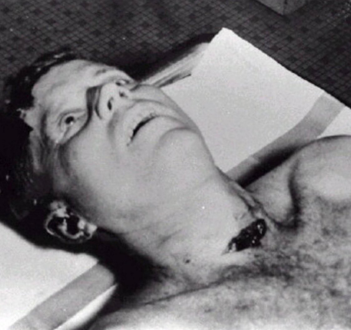 pablovaldezpy's tweet photo. Los medios ni ahí están con las revelaciones sobre el asesinato de John F. Kennedy. Ejemplo, esta foto y lamento que se haya divulgado pero ya está, ya es viral, debería ser objeto del siguiente análisis: ¿hay orificio de entrada en la frente? La herida del cuello es de salida. https://t.co/bdMsYfII2v