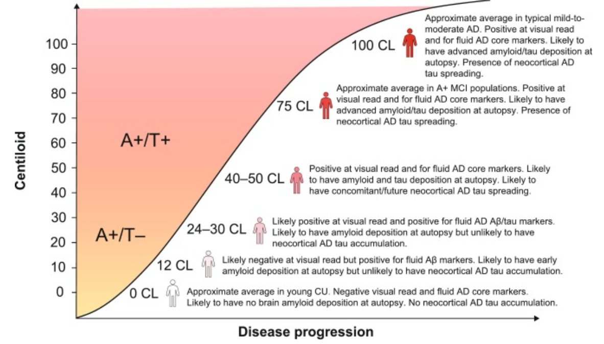 eic_nic's tweet image. Practical overview of the use of amyloid-PET Centiloid values in clinical trials and research
Iaccarino et al.
sciencedirect.com/science/articl…
