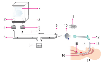 JaypeeJournals's tweet photo. 🤔Must-know Facts about Ventilators for Nurses Working in Intensive Care Units🏥
👇Notes on Humidifier and Heat Moisture Exchanger (HME) facts. Read here: https://t.co/13nBleTX7C
#NJEM #ICUs #criticalcare #emergencymedicine https://t.co/DlHfB1RSvj