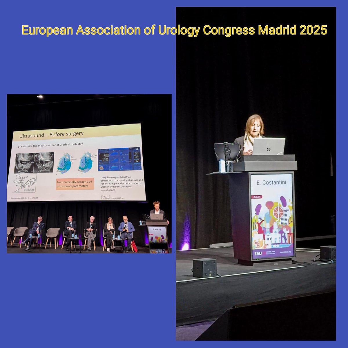 elisabetta costantin (@ecostant1) on Twitter photo #eau2025 Female stress urinary incontinence at # Esffu meeting. Great chair <a href="/EFinazziAgro/">Enrico Finazzi Agrò</a> <a href="/Uroweb/">European Association of Urology (EAU)</a> @uroweb <a href="/icsoffice/">ICS</a> #eau2025 Female stress urinary incontinence at # Esffu meeting. Great chair <a href="/EFinazziAgro/">Enrico Finazzi Agrò</a> <a href="/Uroweb/">European Association of Urology (EAU)</a> @uroweb <a href="/icsoffice/">ICS</a>