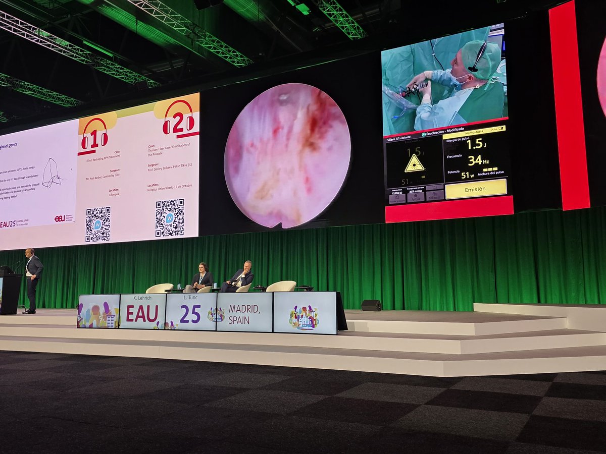 NEU Meram Urology (@meramurology_) on Twitter photo Excitement at #EAU25 ! A live Thulium Fiber Laser Enucleation of the Prostate performed by <a href="/Dmitry_Enikeev/">Dmitry Enikeev</a> and moderated by <a href="/proflutfitunc/">Prof. Dr. Lütfi Tunç</a> . A remarkable showcase of cutting-edge laser technology ! <a href="/Uroweb/">European Association of Urology (EAU)</a> Excitement at #EAU25 ! A live Thulium Fiber Laser Enucleation of the Prostate performed by <a href="/Dmitry_Enikeev/">Dmitry Enikeev</a> and moderated by <a href="/proflutfitunc/">Prof. Dr. Lütfi Tunç</a> . A remarkable showcase of cutting-edge laser technology ! <a href="/Uroweb/">European Association of Urology (EAU)</a>