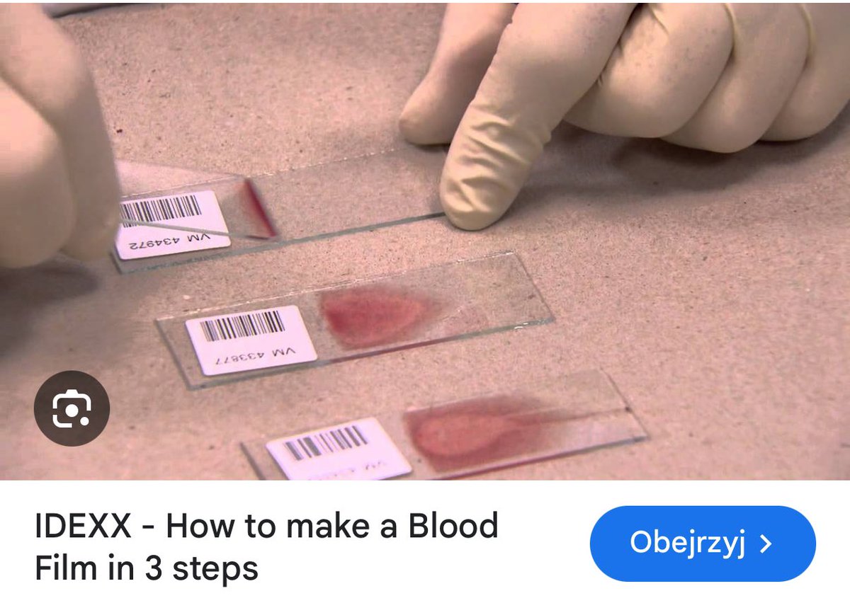 W przypadku podejrzenia malarii u podróżnika, zrób: szybki test antygenowy, rozmazy krwi, PCR malarii - w zależności czym dysponujesz. Jak nie masz nic w.w., nie odsyłaj pacjenta, dzwoń do szpitala zakaźnego lub UCMMiT w Gdyni.