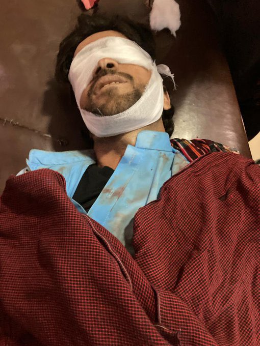 EhsaanBaluch's tweet photo. بلوچستان کے لوگ عید کے کپڑے خریدنے کے بجائے کفن کا کپڑا خرید کہی کفن کم نا پڑ جائیں
#StopBalochGenocide 
#ReleaseDrMahranghBaloch https://t.co/HKfvYsevzI