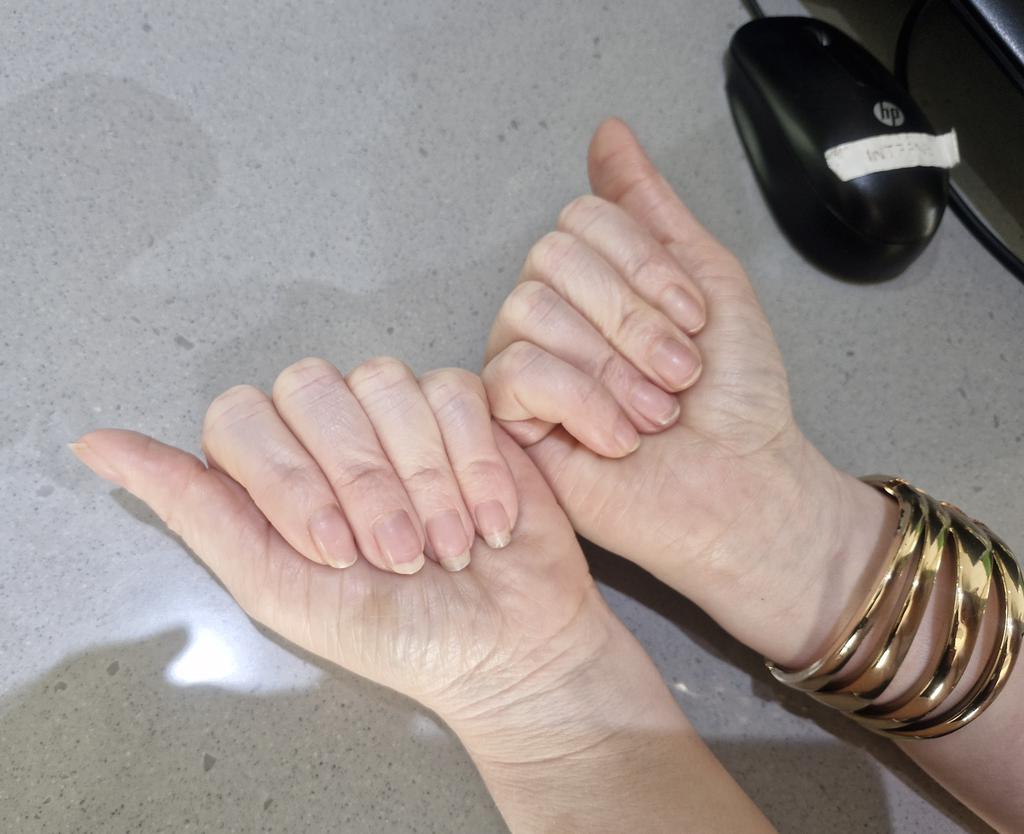 🚨 Nail emergency! Send help! 💅 😂

<a href="/Puleng_pg/">pulengmolebatsi</a> says her nails need some serious TLC! 🫣💔 &amp; she’s putting them under professional review as we dive into all things nail care this hour ✨

Drop your best nail care tips below - Puleng needs them! 👇😂

#OutAndAbout