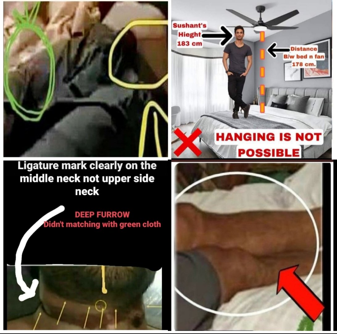 This is no suicide, u can make us believe a lot of things but not this one.
🩸Ligature mark on SSR neck indicates strangulation.
🩸Legs broken
🩸Bruises/injuries on body
🩸Forensic Report says: possibility of Homicide. <a href="/CBIHeadquarters/">Central Bureau of Investigation (India)</a>

Power Blocking SSRCase
302 delayed in probe