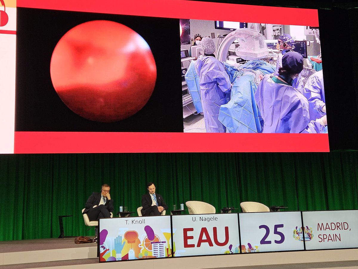 Vincent De Coninck (@vdconinck) on Twitter photo Excellent demonstration of save, fast and efficient transpapillary puncture and laser lithotripsy by <a href="/drmarcoscepeda/">Marcos Cepeda</a> #EAU25 <a href="/Uroweb/">European Association of Urology (EAU)</a> Excellent demonstration of save, fast and efficient transpapillary puncture and laser lithotripsy by <a href="/drmarcoscepeda/">Marcos Cepeda</a> #EAU25 <a href="/Uroweb/">European Association of Urology (EAU)</a>