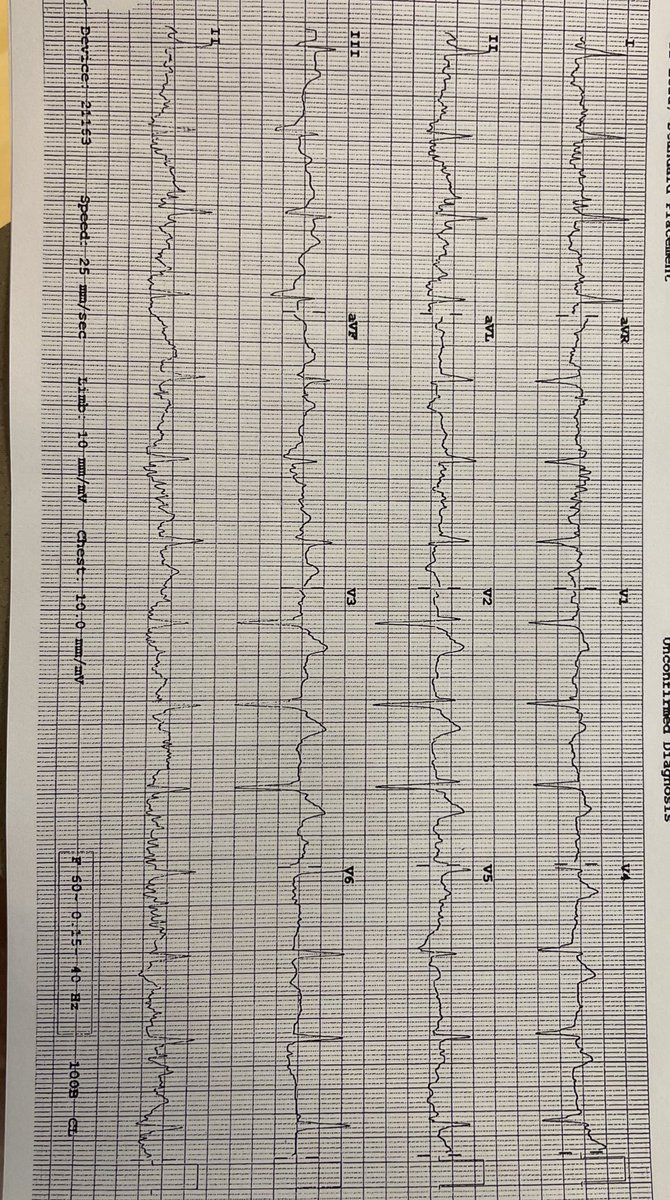 Tom Wilson tweet media