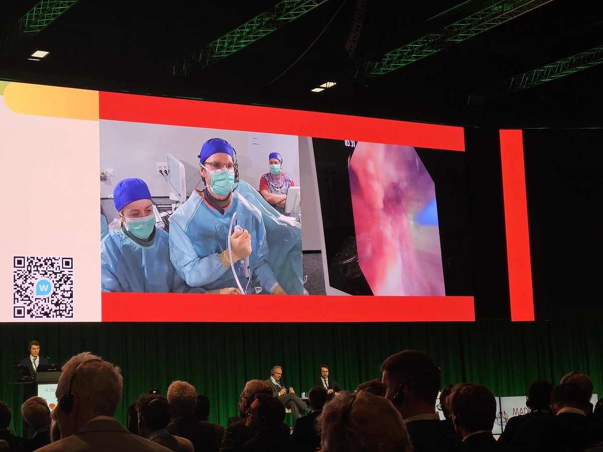 Vincent De Coninck (@vdconinck) on Twitter photo Very nice RIRS procedure by <a href="/exkeller/">Etienne Xavier Keller</a> #EAU25.
Congratulations!!
<a href="/PEARLSendouro/">PEARLS</a> <a href="/YAUEndourology/">YAU ENDOUROLOGY</a> Very nice RIRS procedure by <a href="/exkeller/">Etienne Xavier Keller</a> #EAU25.
Congratulations!!
<a href="/PEARLSendouro/">PEARLS</a> <a href="/YAUEndourology/">YAU ENDOUROLOGY</a>