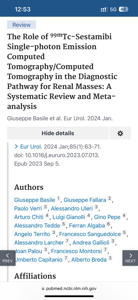 Paolo Verri (@paoloverri05) on Twitter photo <a href="/BasileG_/">Giuseppe_Basile</a> outlining the latest updates on #imaging technologies available to better identify #renal masses, presenting the results of our study published in <a href="/EuropeanUrology/">European Urology</a>.
🩻precise imaging can dramatically change patient’s management!
#EAU25 <a href="/Uroweb/">European Association of Urology (EAU)</a> <a href="/BasileG_/">Giuseppe_Basile</a> outlining the latest updates on #imaging technologies available to better identify #renal masses, presenting the results of our study published in <a href="/EuropeanUrology/">European Urology</a>.
🩻precise imaging can dramatically change patient’s management!
#EAU25 <a href="/Uroweb/">European Association of Urology (EAU)</a>