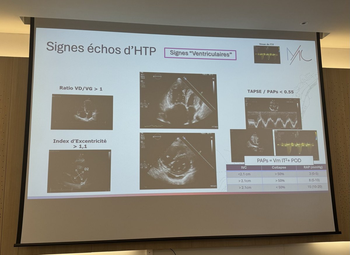 SABOURETCardio's tweet photo. #MonacoMedicalCourse #PAH by Pr Moceri https://t.co/krDpE7DqAs