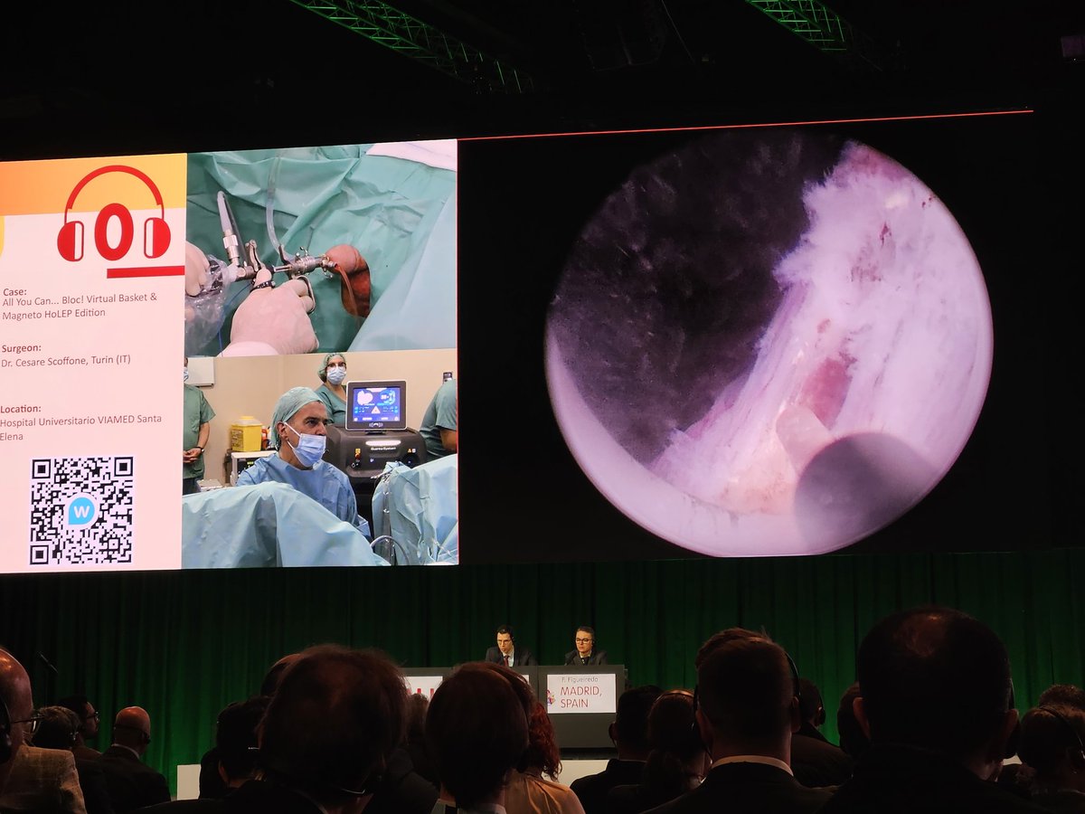 Vincent De Coninck (@vdconinck) on Twitter photo Excellent and very didactic live HoLEP procedures by <a href="/scoffonecesare/">scoffone cesare</a> and <a href="/fgomsan/">Fernando GomezSancha</a> with many tips and tricks :
Very short pausing time, wide efficient movements during laser enucleation, instrument handling, solving morcellation issues,...
#EAU25 Excellent and very didactic live HoLEP procedures by <a href="/scoffonecesare/">scoffone cesare</a> and <a href="/fgomsan/">Fernando GomezSancha</a> with many tips and tricks :
Very short pausing time, wide efficient movements during laser enucleation, instrument handling, solving morcellation issues,...
#EAU25