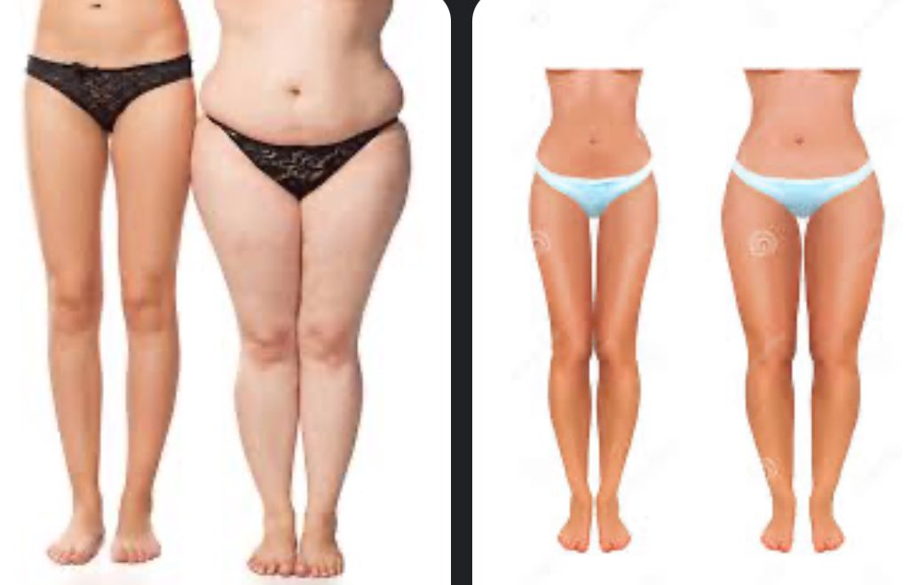 glowupcals's tweet image. It’s your choice. Really, it’s all you and your decisions in your head. Don’t blame other things when summer comes around and you look the same or even bigger.