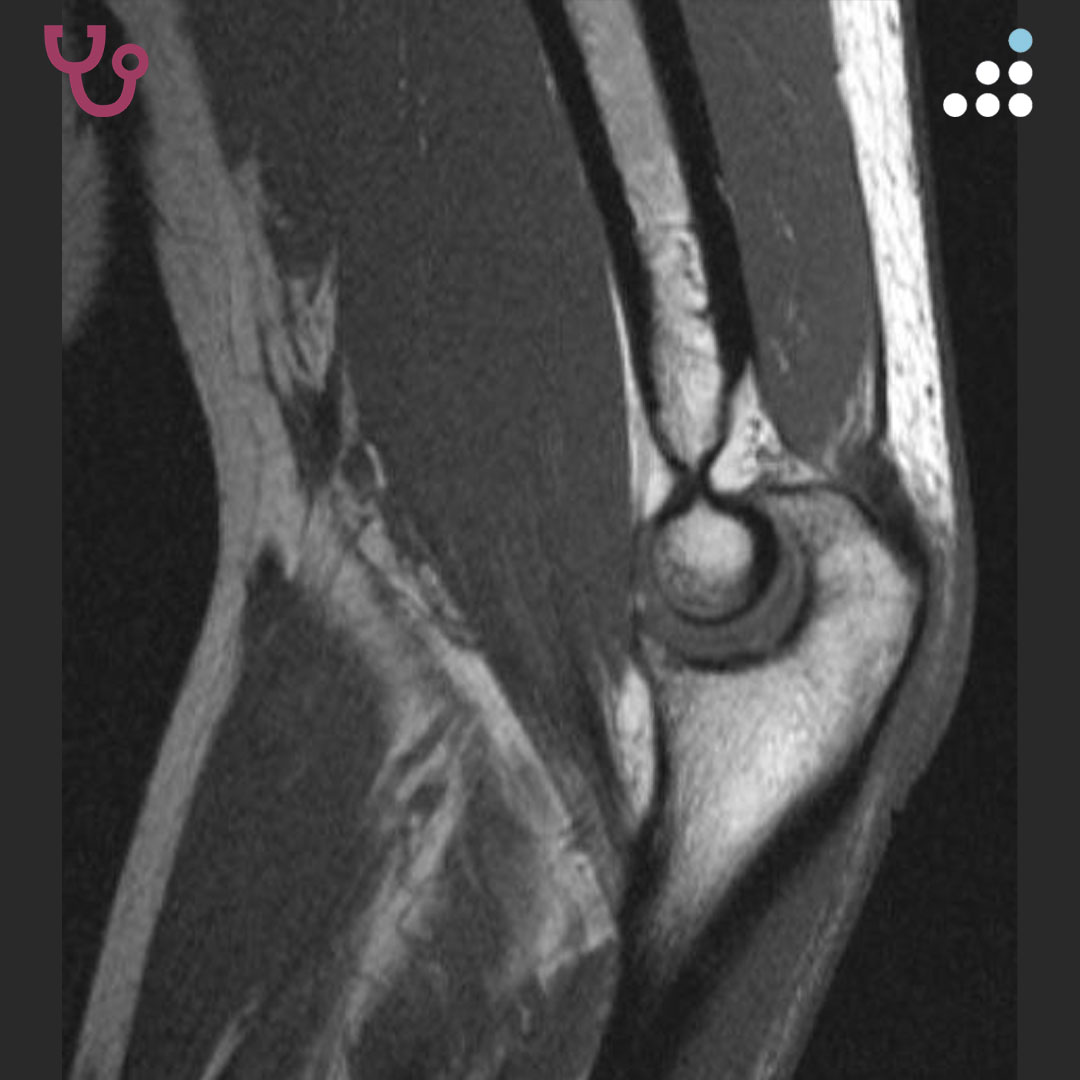 Orthobullets tweet media