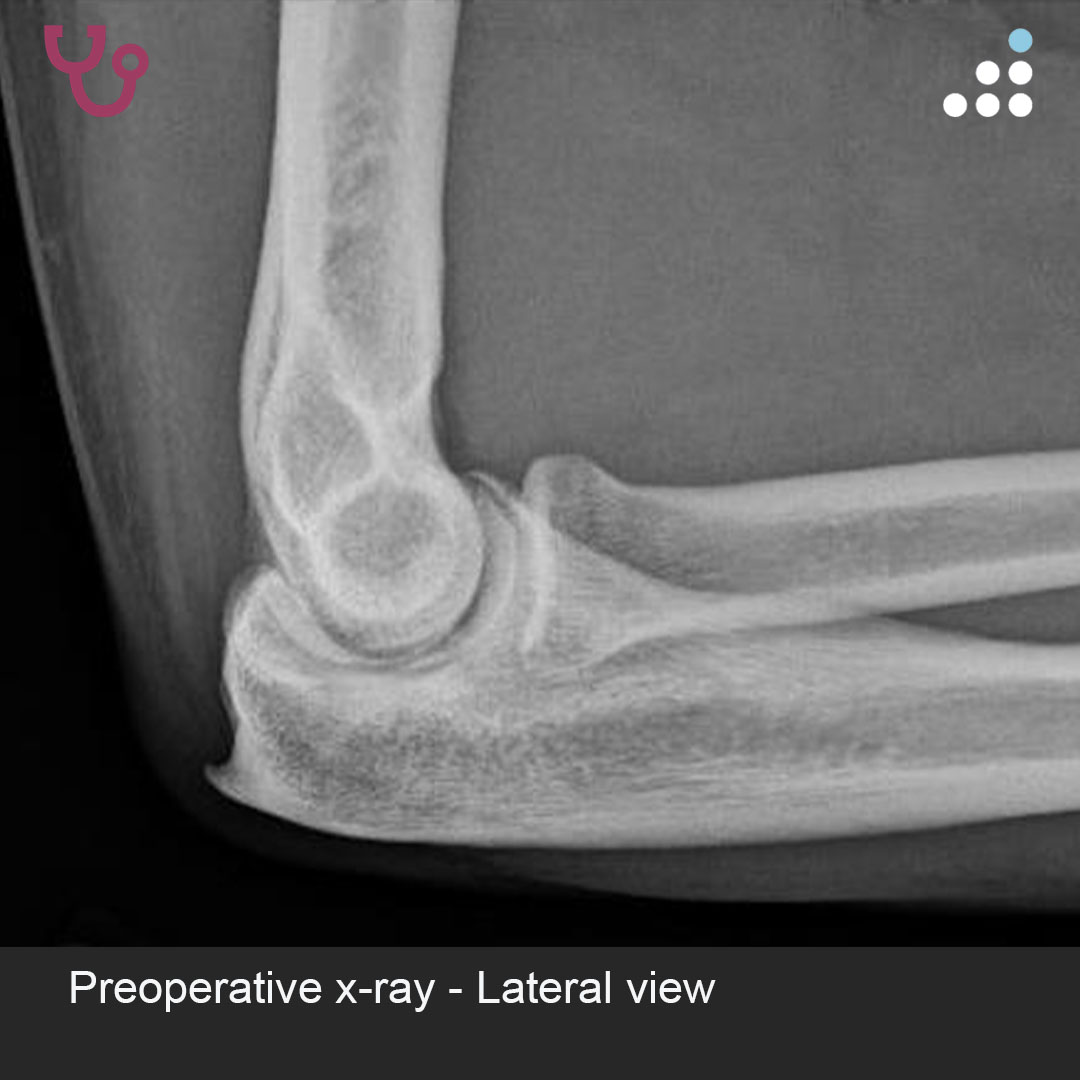 Orthobullets tweet media