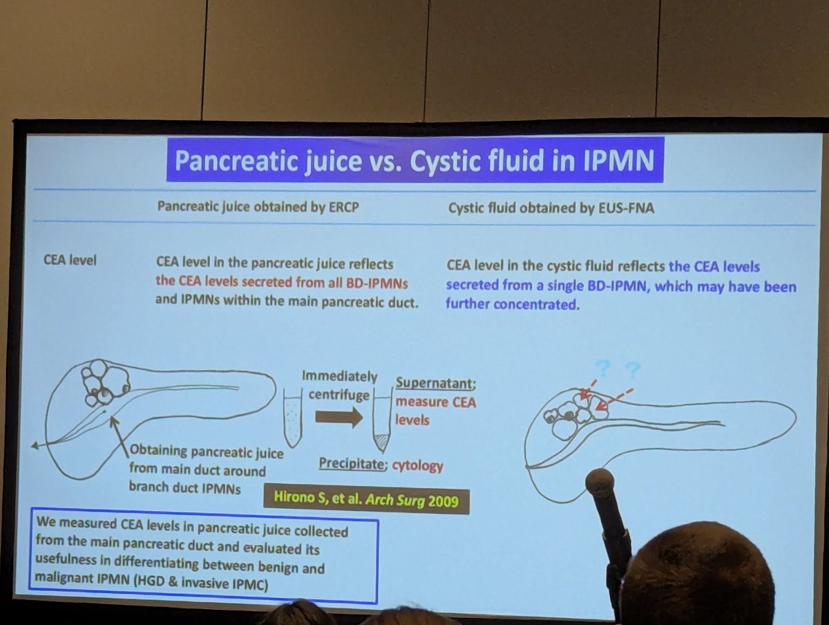 Kumar Krishnan (@krishnanendo) on Twitter photo Update on pancreatic cysts <a href="/AHPBA/">AHPBA</a> . Clearly genomic based testing is the future to help guide treatment options. Unfortunately for now, the debate continues.... ๐ ๐ Or ๐ช๐ช!!
<a href="/AmerGastroAssn/">American Gastroenterological Association (AGA)</a> <a href="/DeMadaria/">Enrique de-Madaria</a> <a href="/OfficialPCA/">Pancreatic Cancer Action</a> <a href="/PancreasClub/">The Pancreas Club</a> Update on pancreatic cysts <a href="/AHPBA/">AHPBA</a> . Clearly genomic based testing is the future to help guide treatment options. Unfortunately for now, the debate continues.... ๐ ๐ Or ๐ช๐ช!!
<a href="/AmerGastroAssn/">American Gastroenterological Association (AGA)</a> <a href="/DeMadaria/">Enrique de-Madaria</a> <a href="/OfficialPCA/">Pancreatic Cancer Action</a> <a href="/PancreasClub/">The Pancreas Club</a>